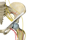 Hip Osteonecrosis